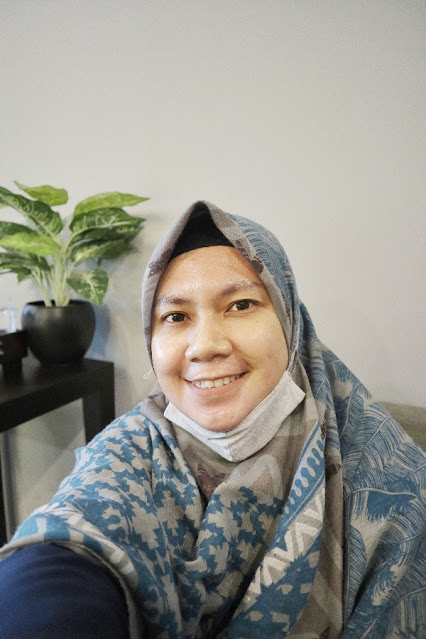 acne center cara mengatasi jerawat dengan acne peeling