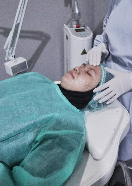 acne center cara mengatasi jerawat dengan acne peeling